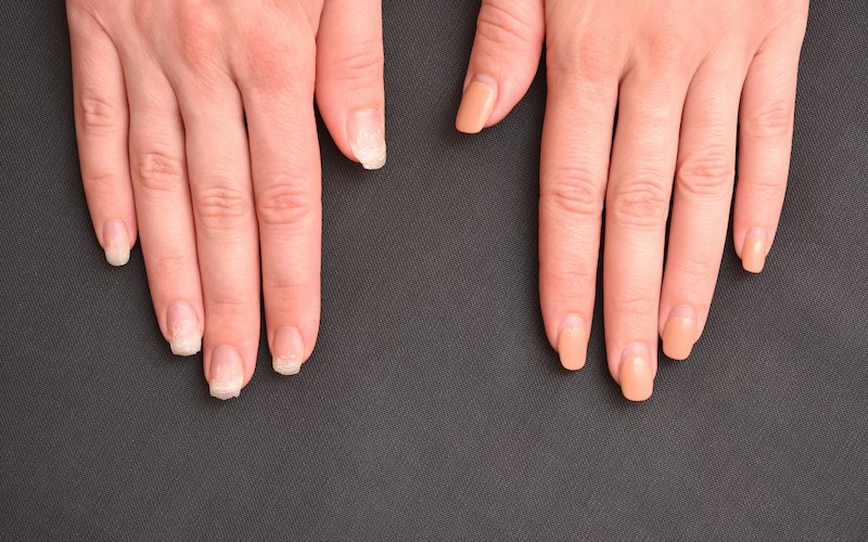 How Often Should You Get a Manicure for Healthy Nails?