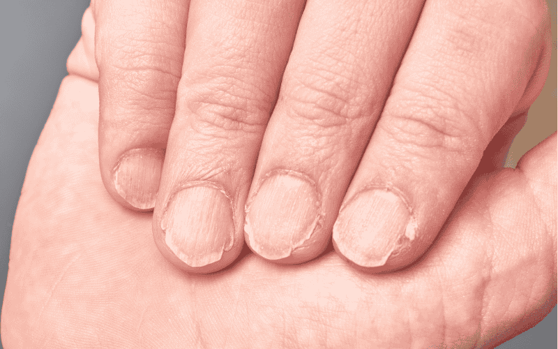 nails that need a manicure nails that need a manicure