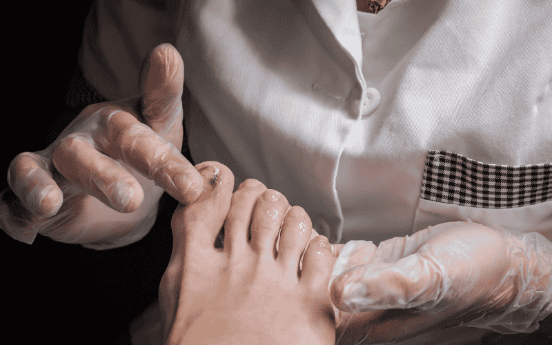 What Kills Toenail Fungus the Fastest? Evidence-Based Treatments That Actually Work